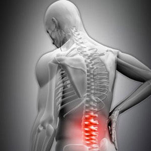Spine Tumour Treatment by the Cancer Experts in Delhi